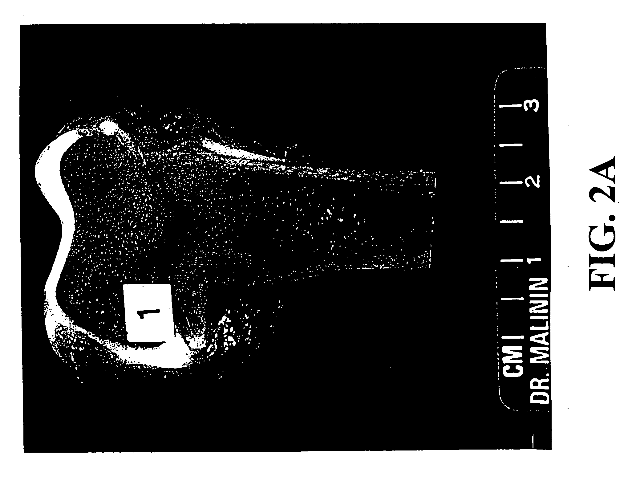 Transplantable particulate bone composition having high osteoinductive capacity and methods for making and using same