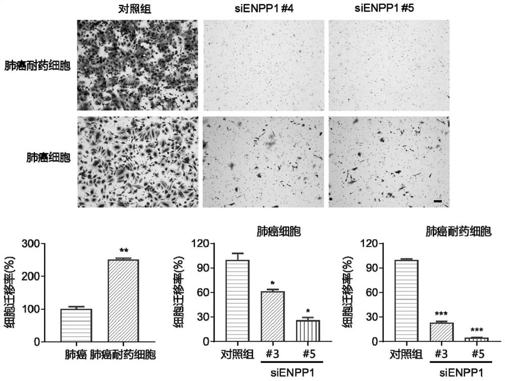 Application of drug combination of ENPP1 inhibitor and anticancer drug to preparation of antitumor drug