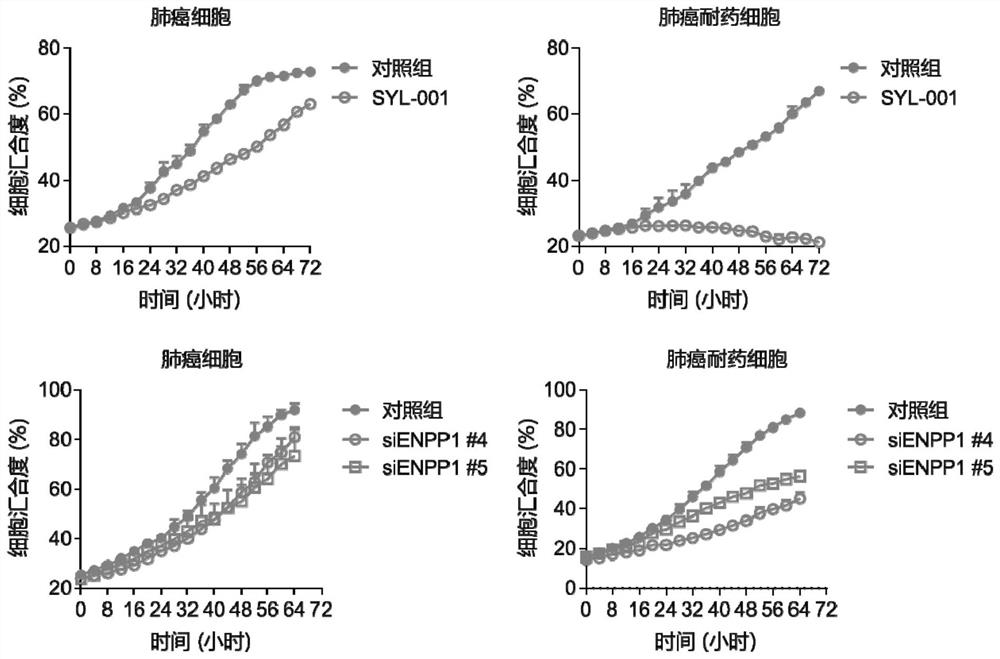 Application of drug combination of ENPP1 inhibitor and anticancer drug to preparation of antitumor drug