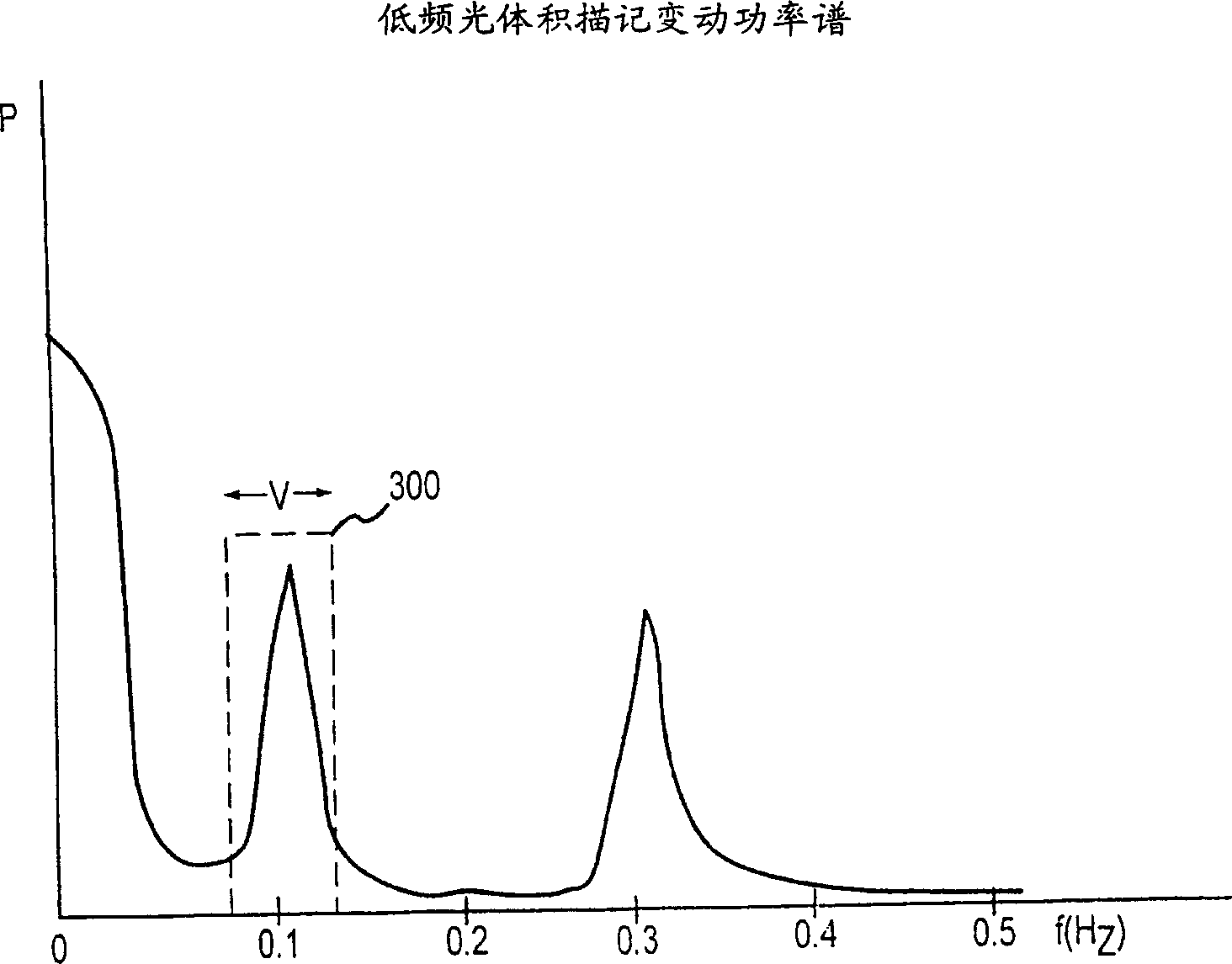 Monitoring physiological parameters based on variations in a photoplethysmographic signal