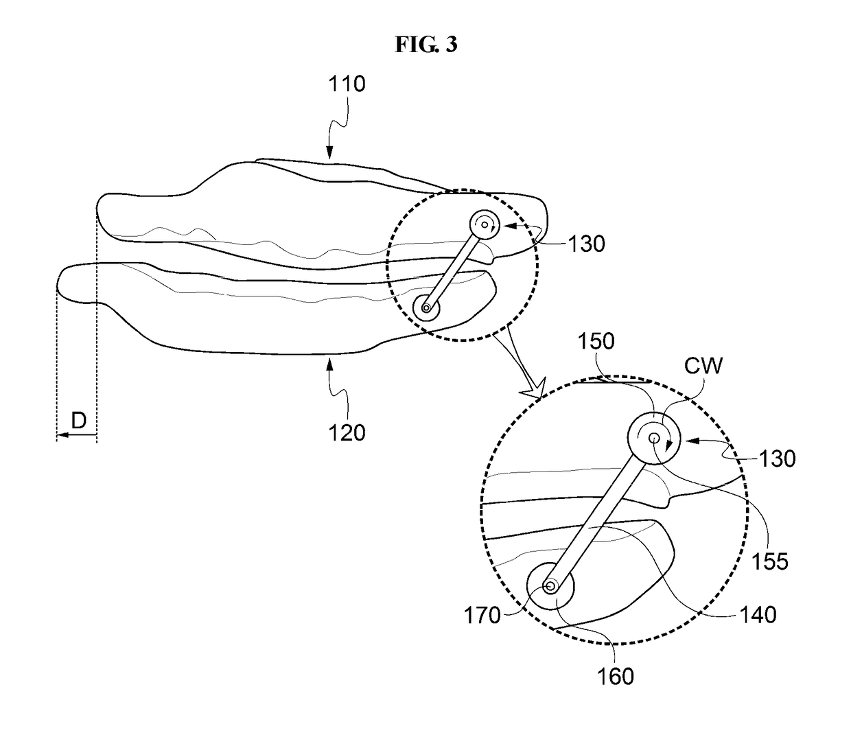 Device for moving lower jaw forward