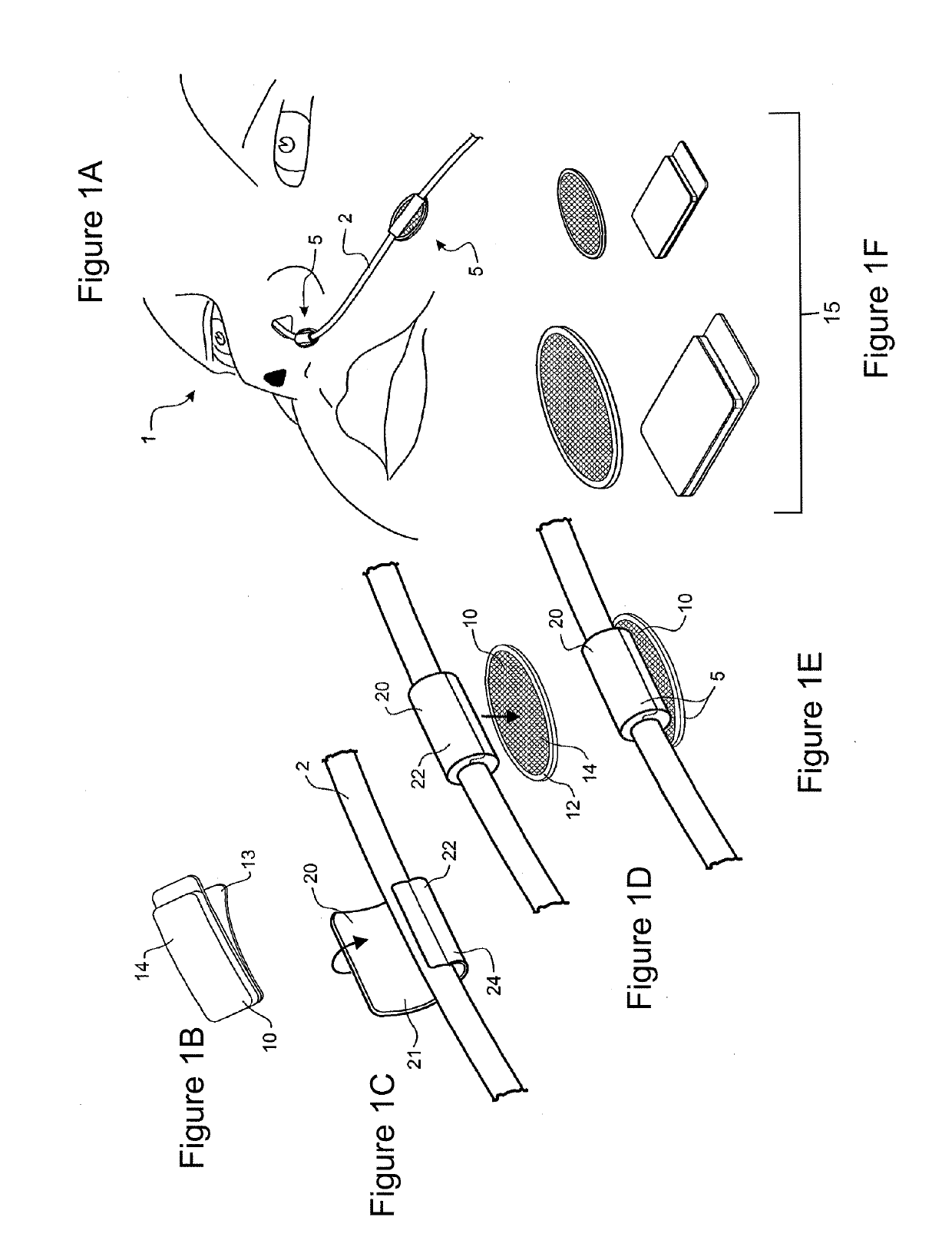 Tube securement system