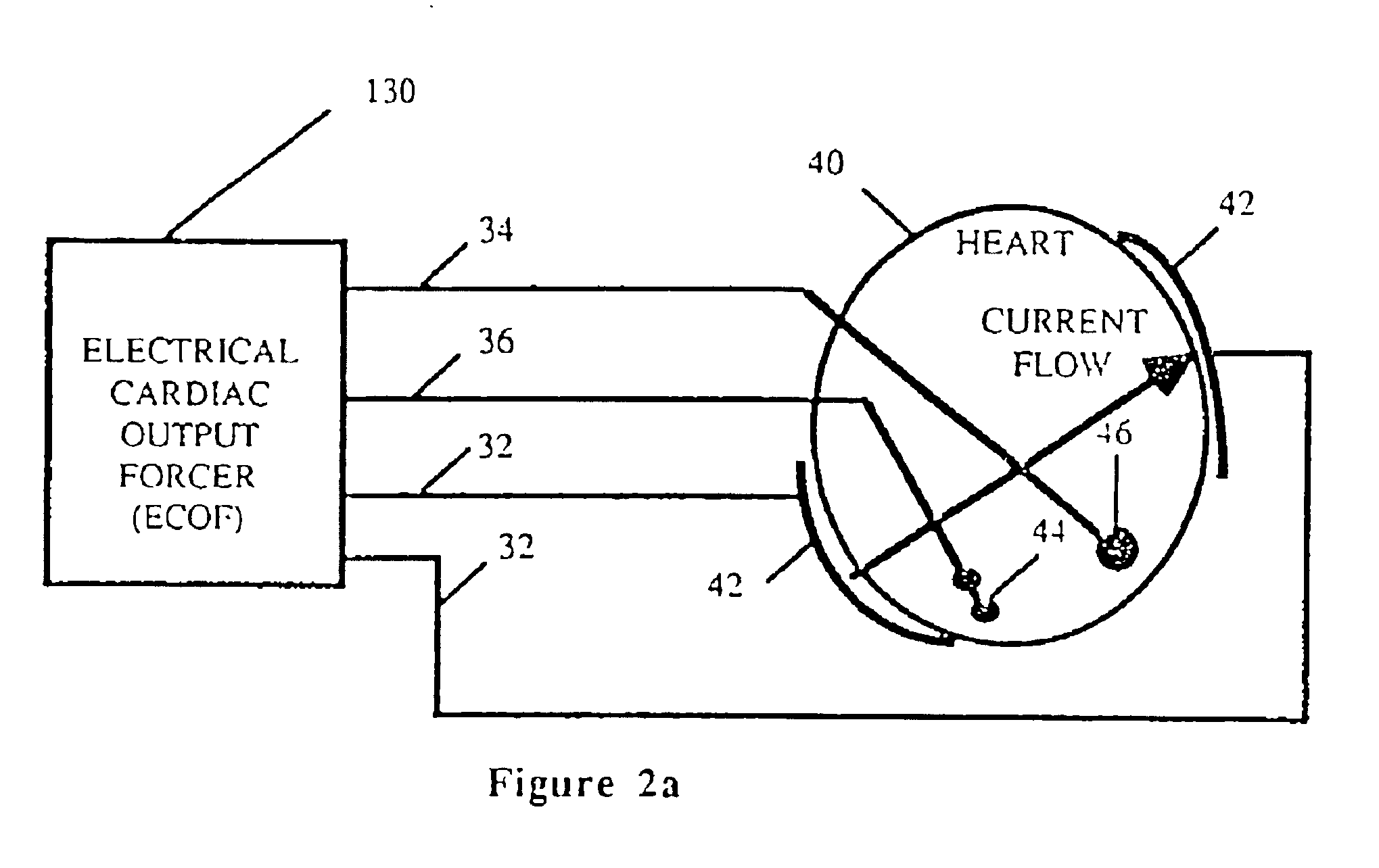 Electrical cardiac output forcer