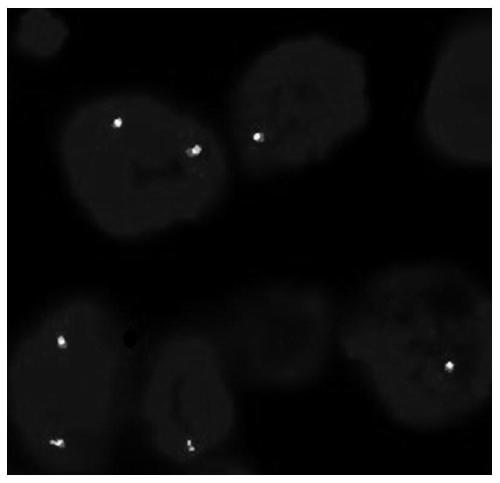 FISH probe set for detecting FGFR2 fusion and application thereof