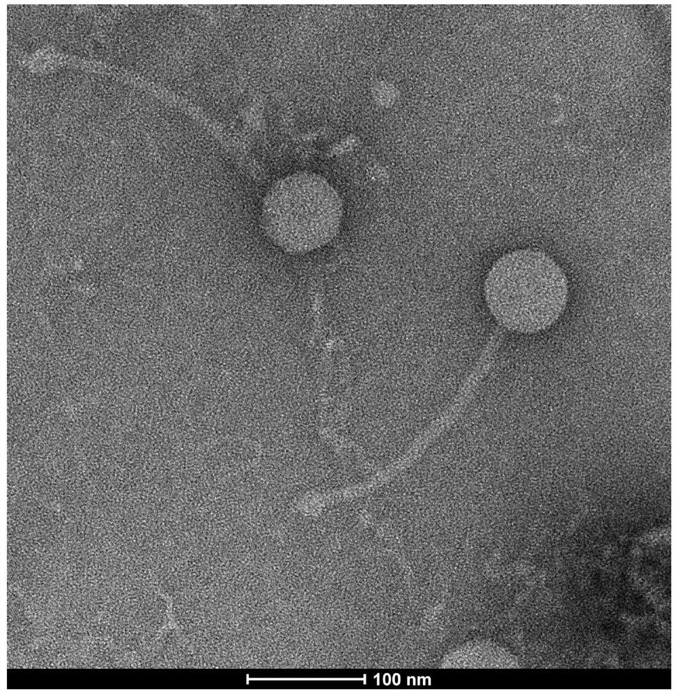 Nocardia anfenacea bacteriophage P69 and application thereof