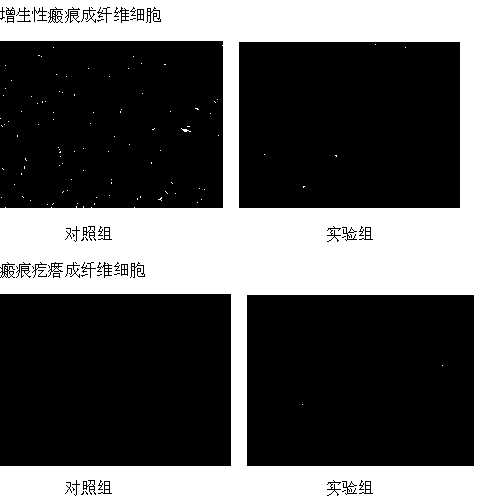 siRNA molecular composition and application thereof in treatment on pathological scars