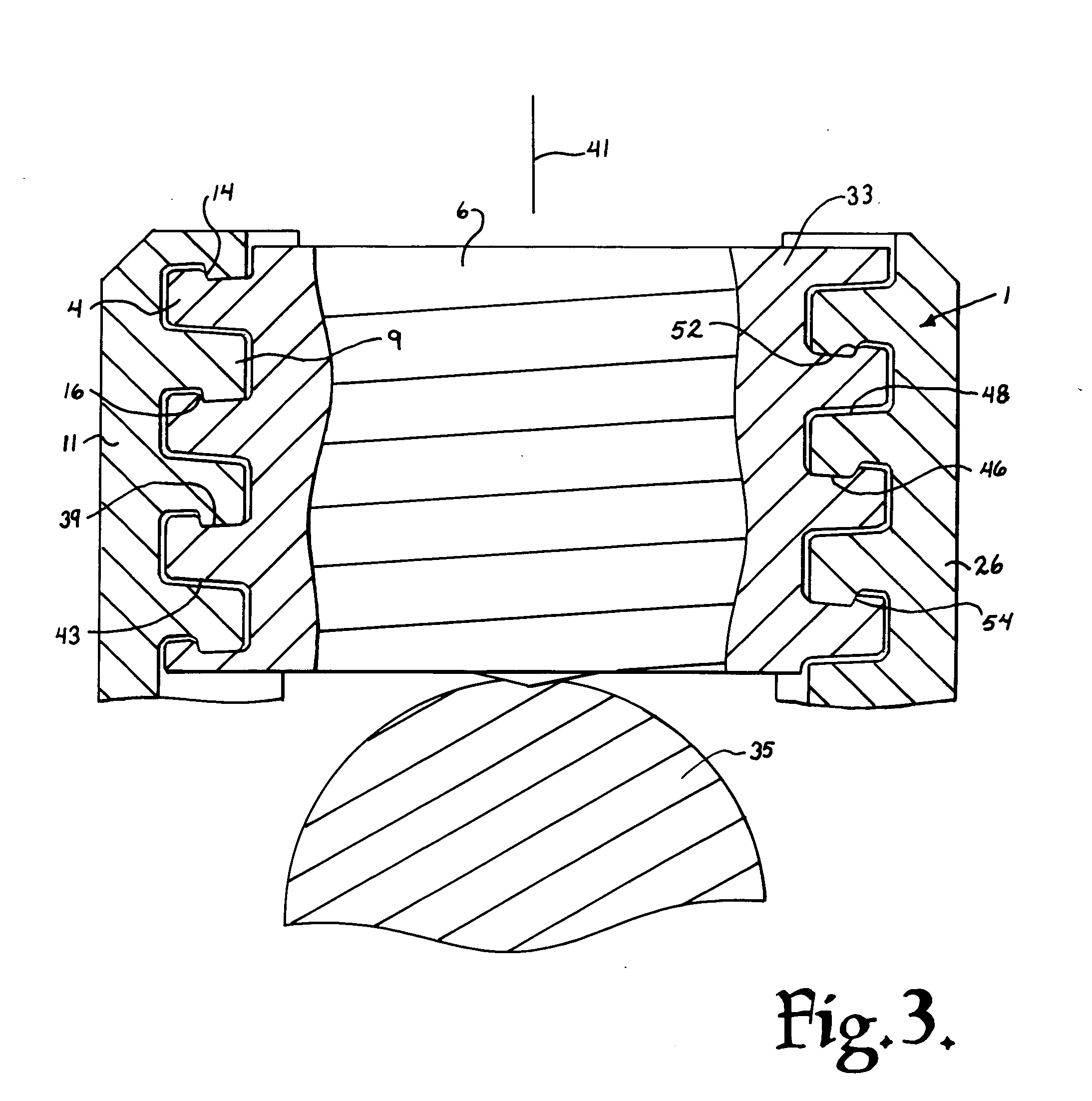 Helical guide and advancement flange with radially loaded lip