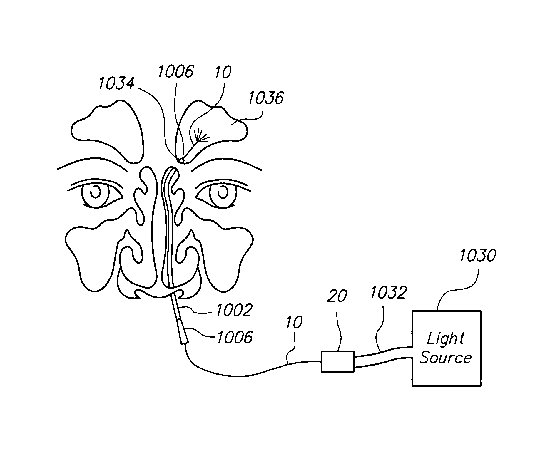 Methods and devices for facilitating visualization in a surgical environment