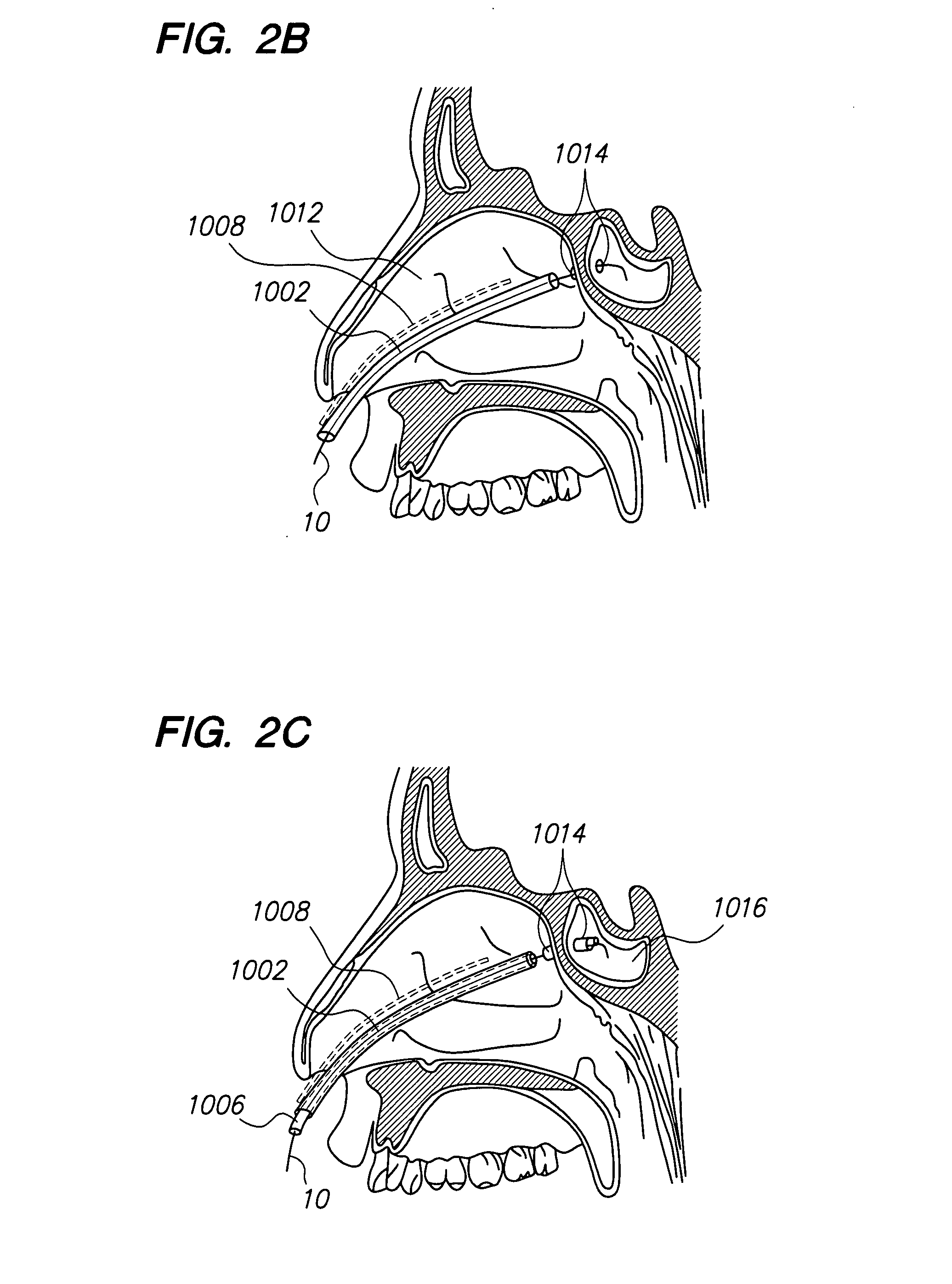 Methods and devices for facilitating visualization in a surgical environment