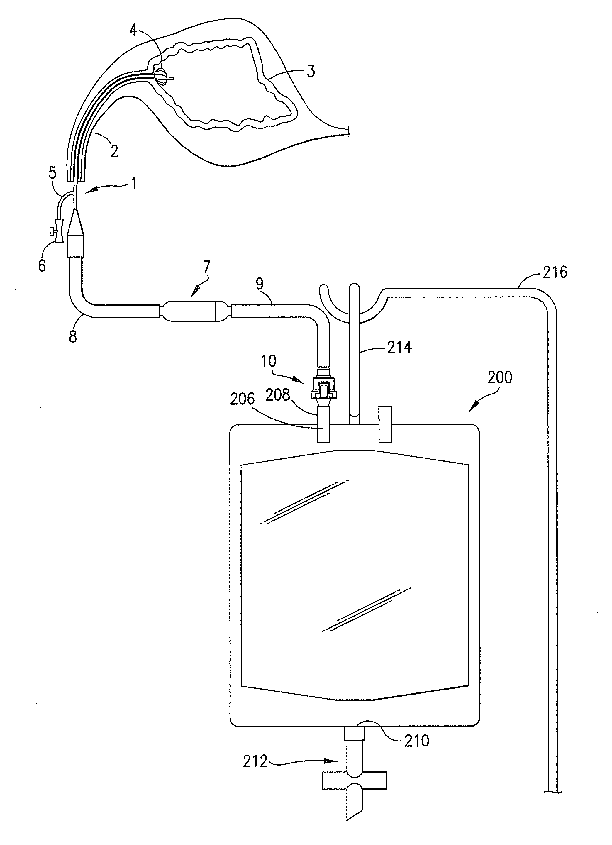 Fluid collection system