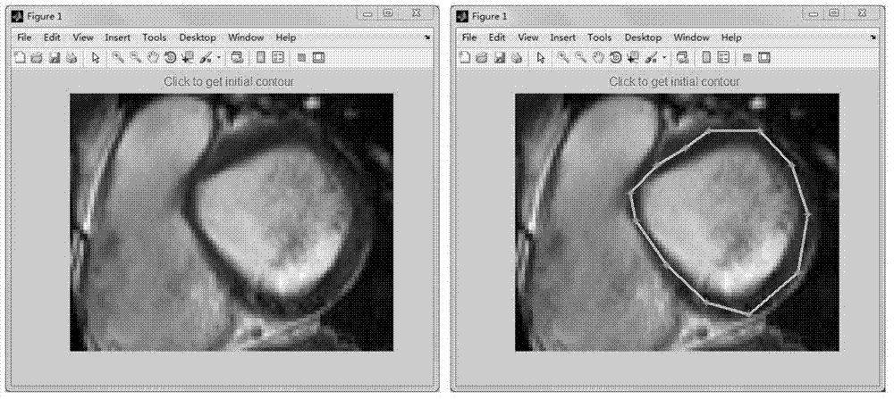 Left ventricle nuclear magnetic resonance image segmentation and three-dimensional reconstruction method