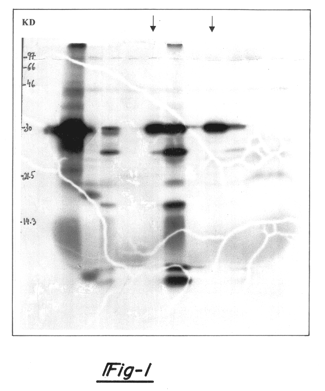 Hypoxia-regulated genes