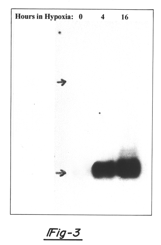 Hypoxia-regulated genes