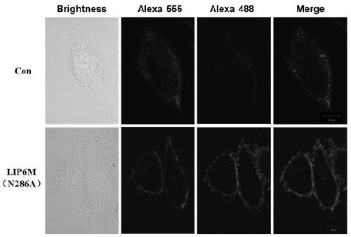 Lamprey immunoprotein LIP mutant capable of acting as tumor diagnosis marker