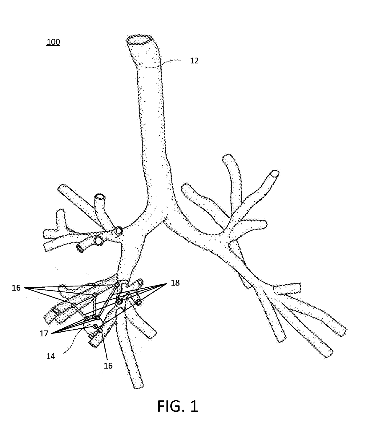 Pathway planning for use with a navigation planning and procedure system