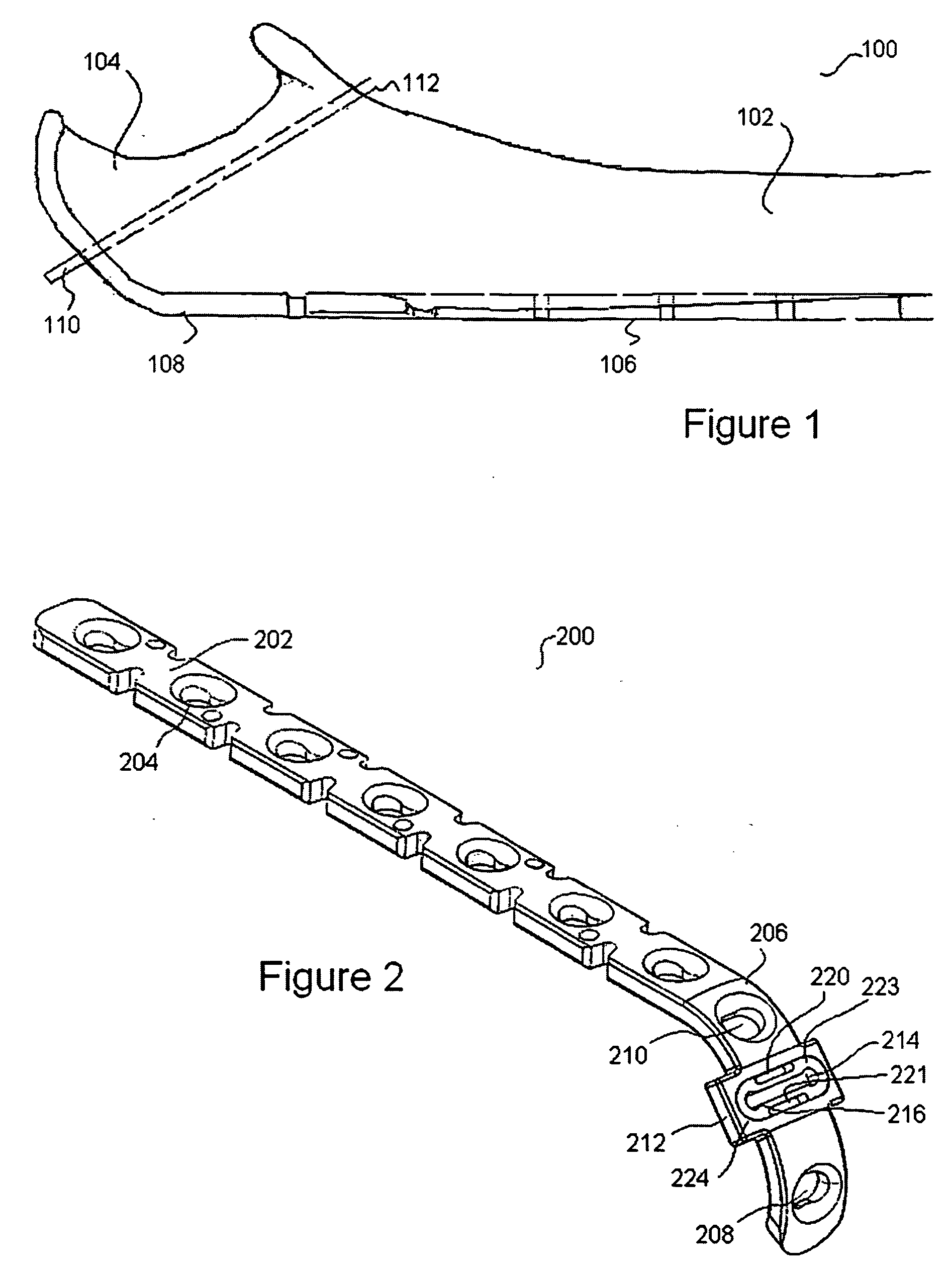 Orthopaedic appliances