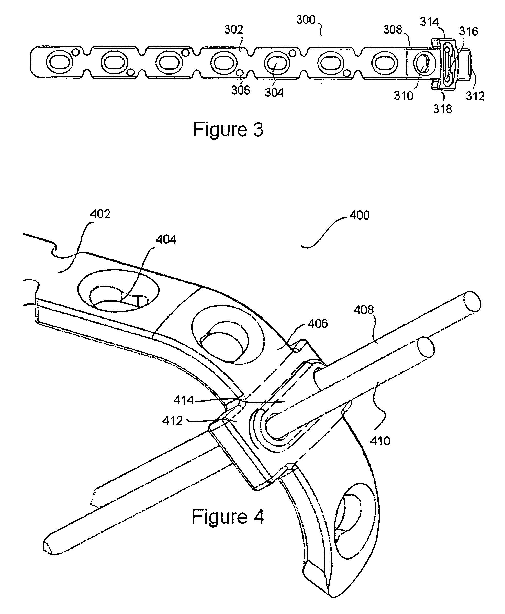 Orthopaedic appliances