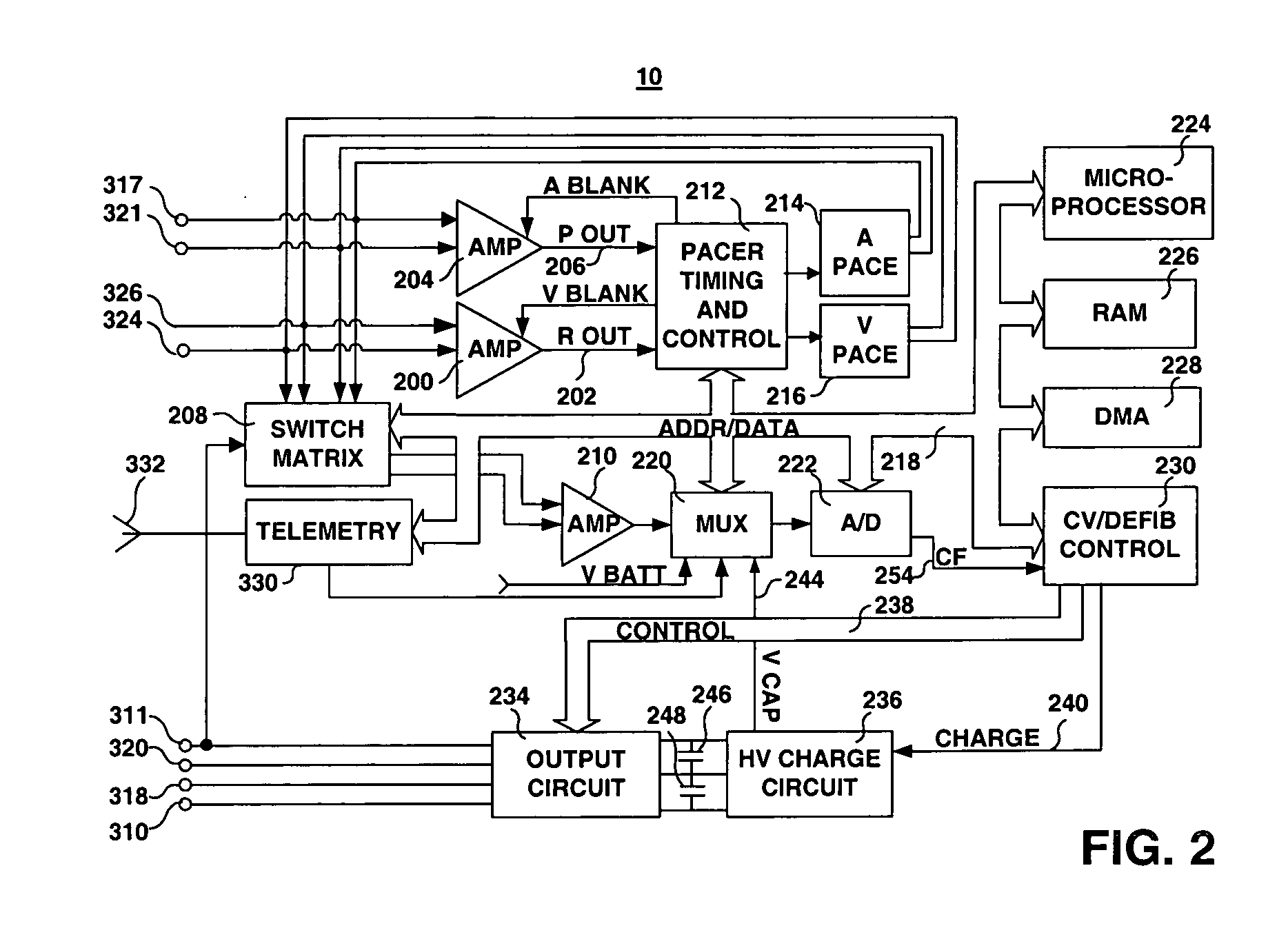 Method and apparatus for detecting and discriminating arrhythmias