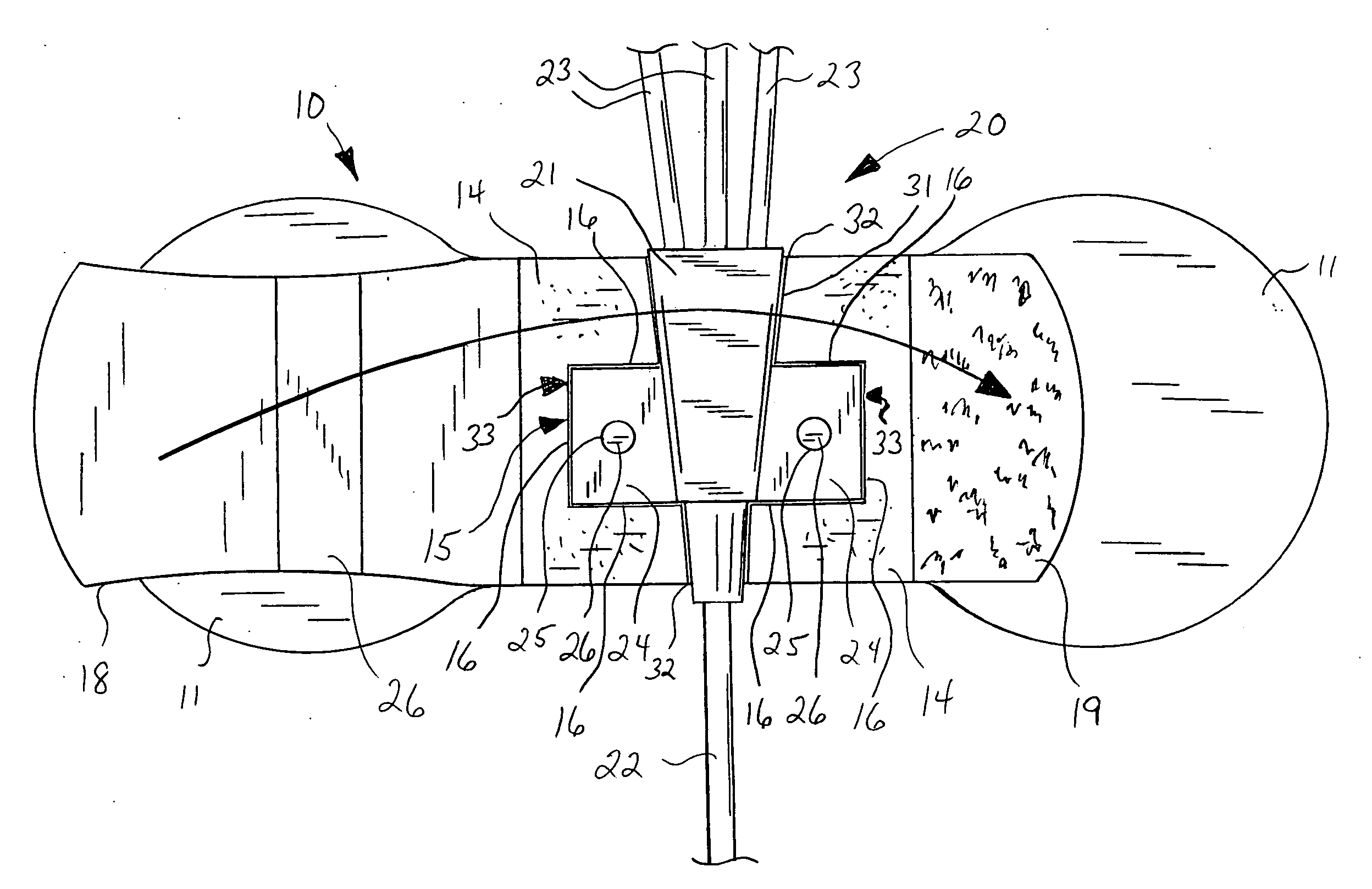 Catheter anchor