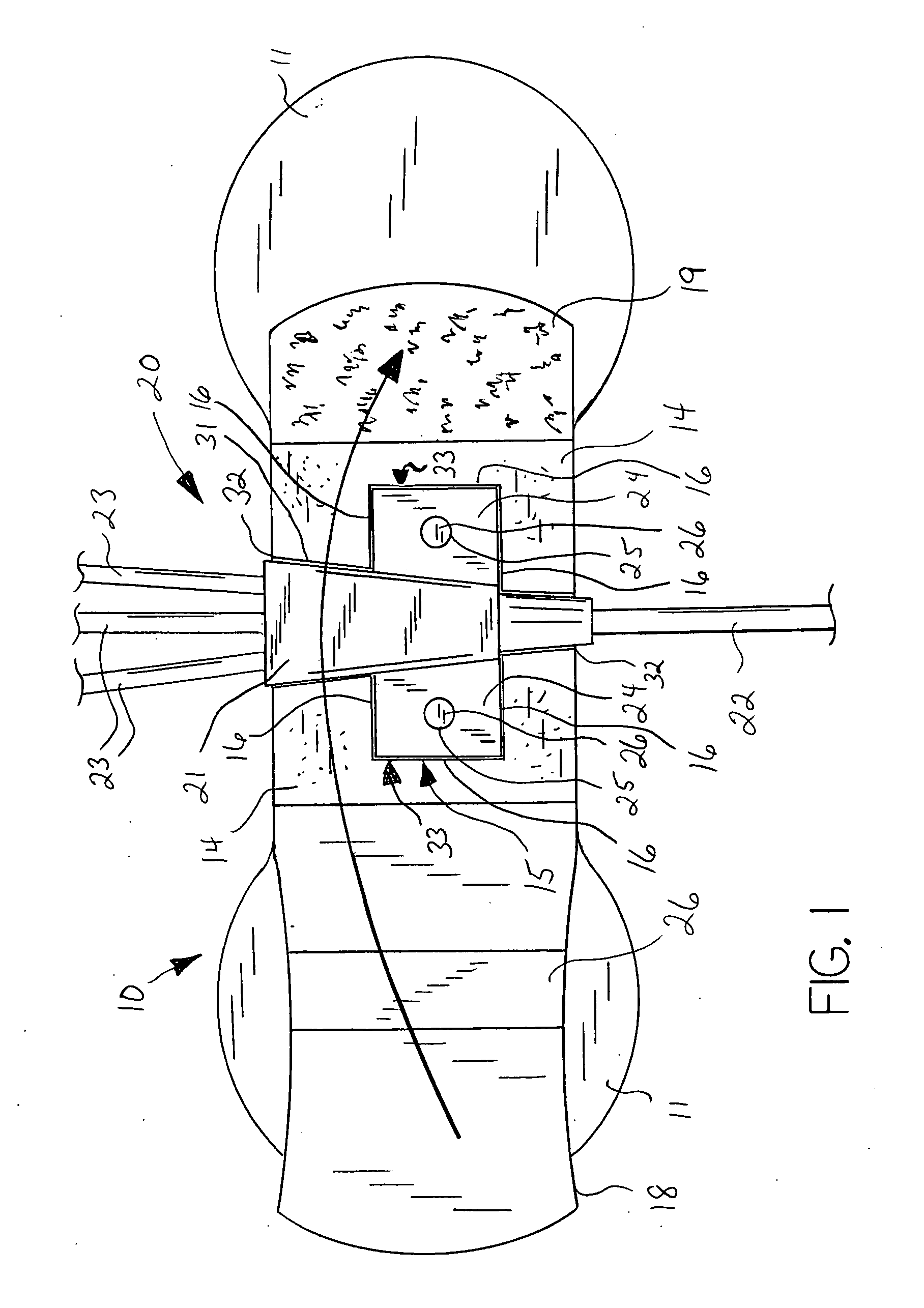 Catheter anchor