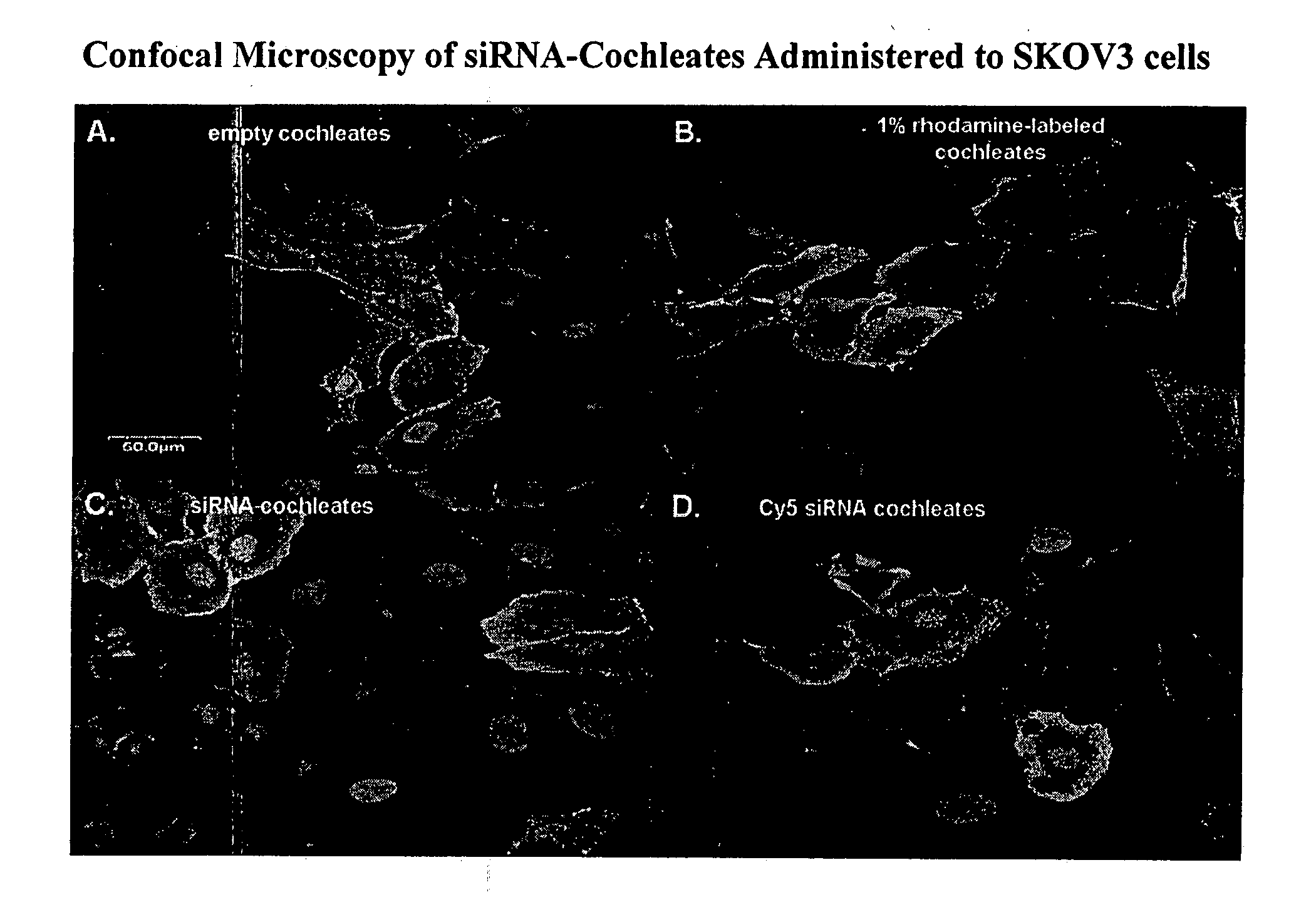 Cochleate compositions directed against expression of proteins