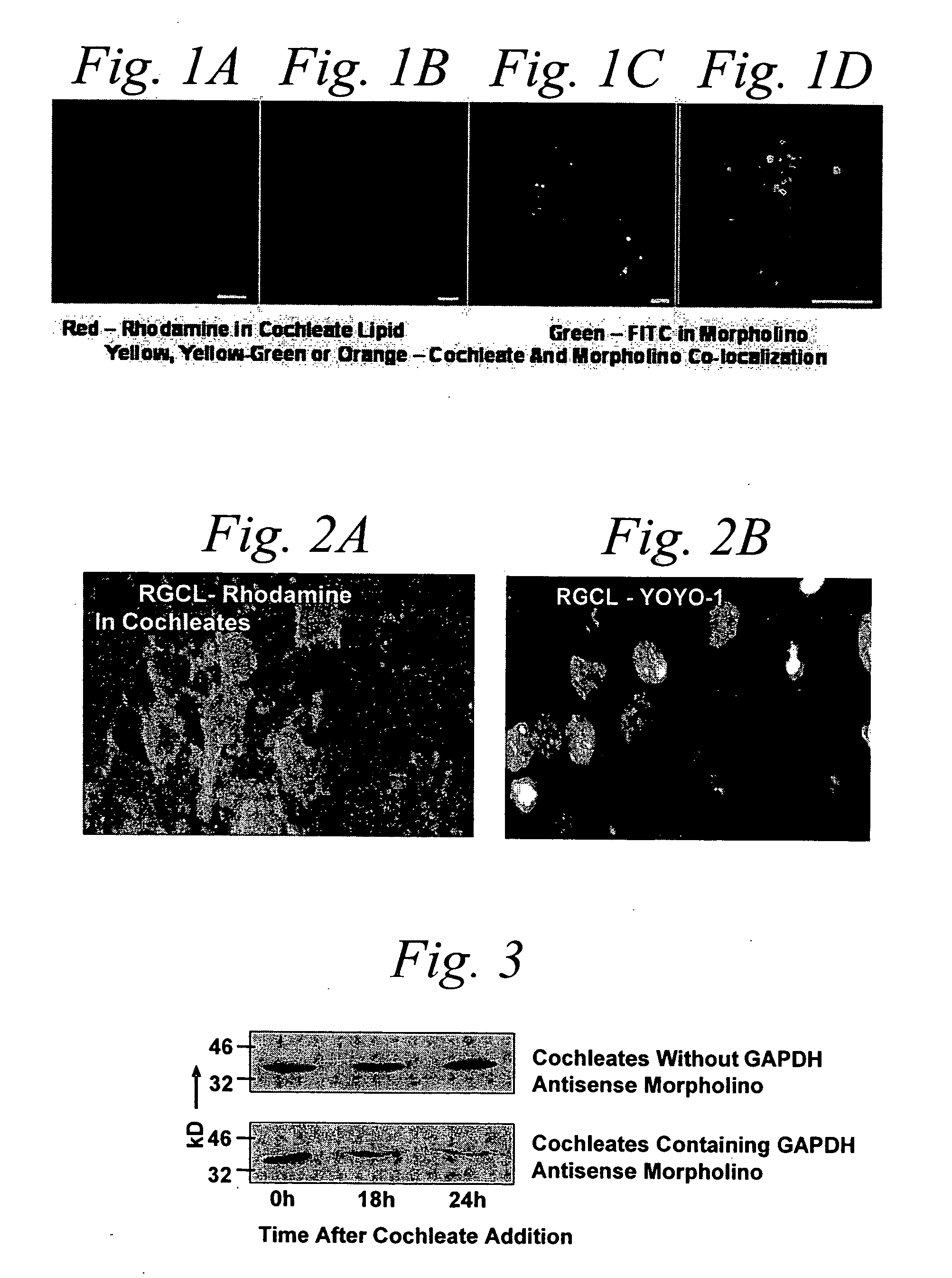 Cochleate compositions directed against expression of proteins