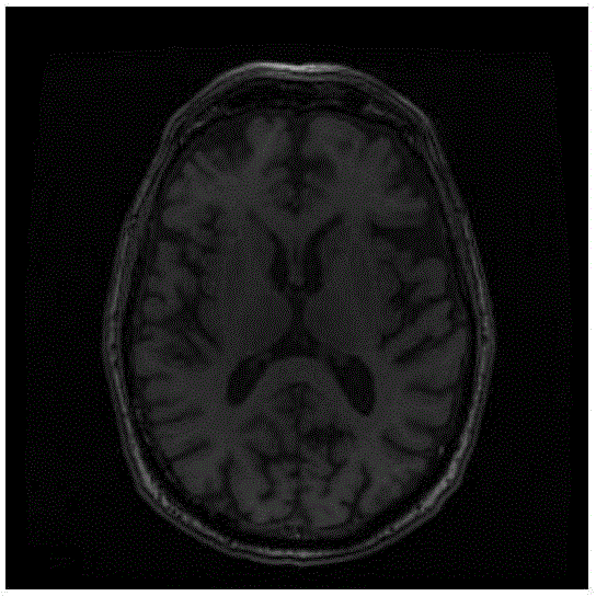 Partition method for multiple-sclerosis damage area