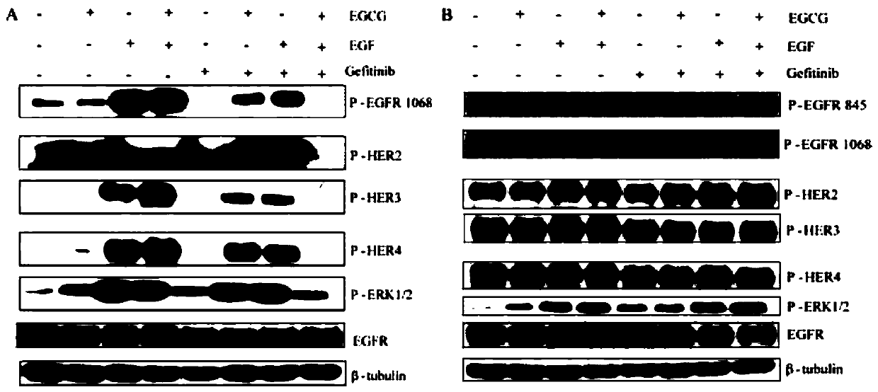 Application of epigallocatechin gallate combined with tyrosine kinase inhibitor in preparation of cancer treatment medicament