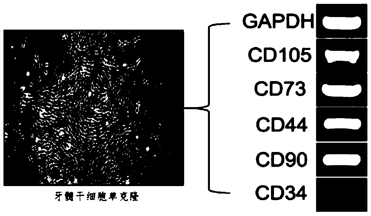 Cell culture method for inducing dental pulp stem cells to differentiate into bladder smooth muscle cells in vitro