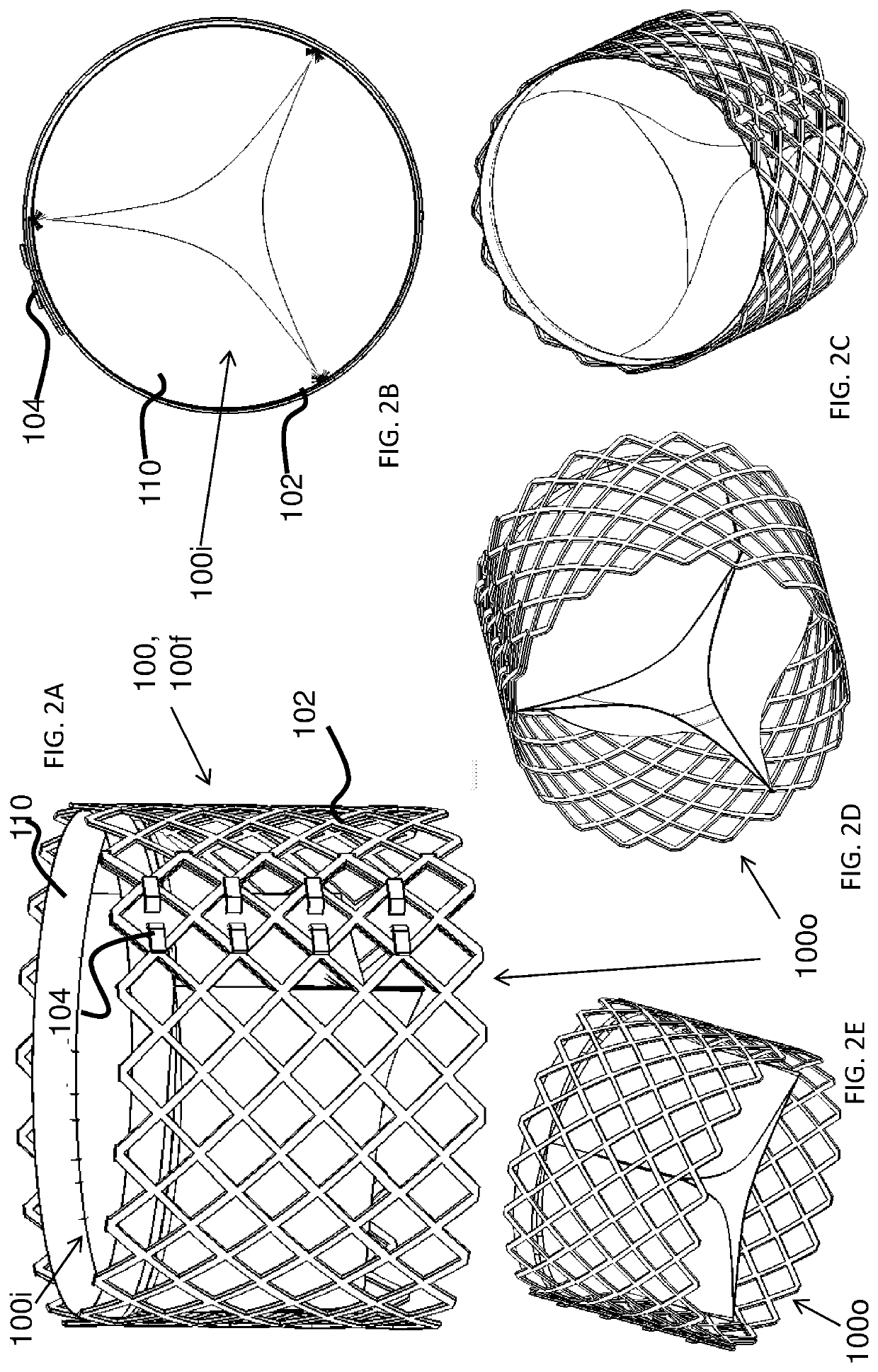 Intraluminal support structure and prosthetic valve from the same