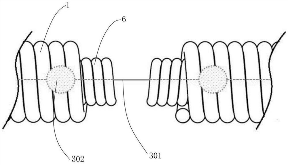 Medical spring ring and conveying system comprising same