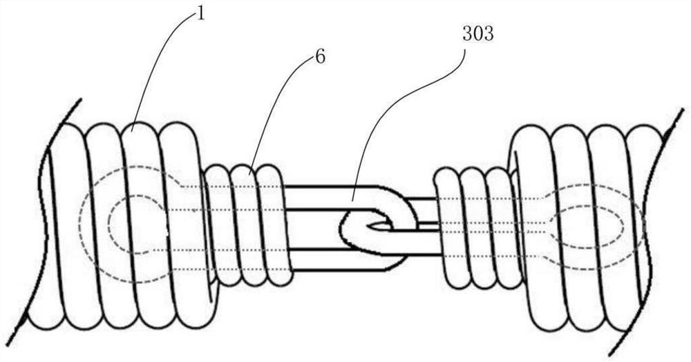 Medical spring ring and conveying system comprising same