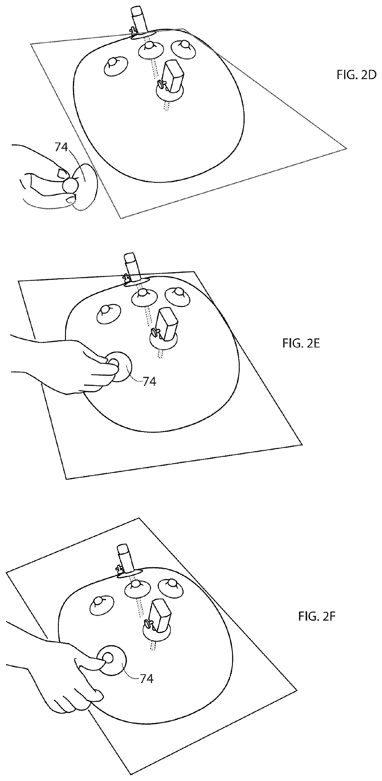 Adhesive medical cover with an inflatable dome