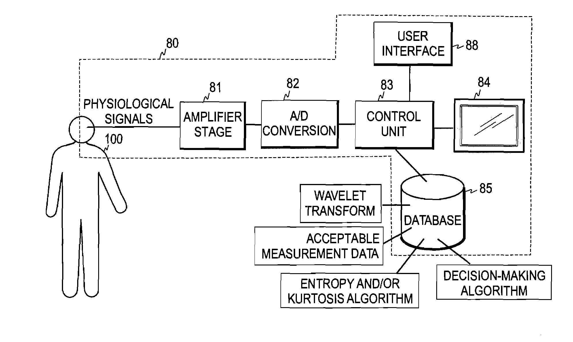 Processing of Physiological Signal Data in Patient Monitoring