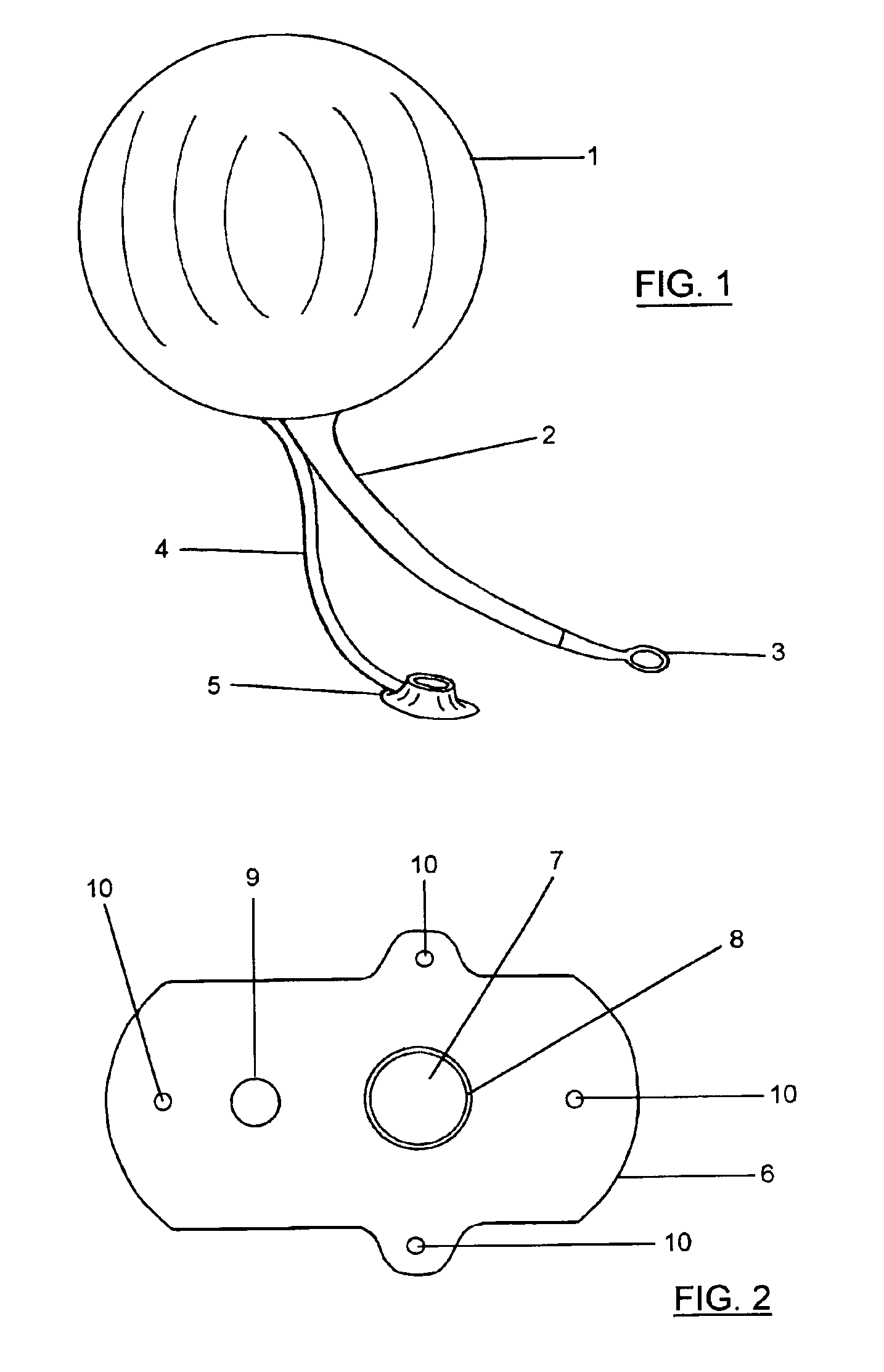 Intragastric balloon assembly