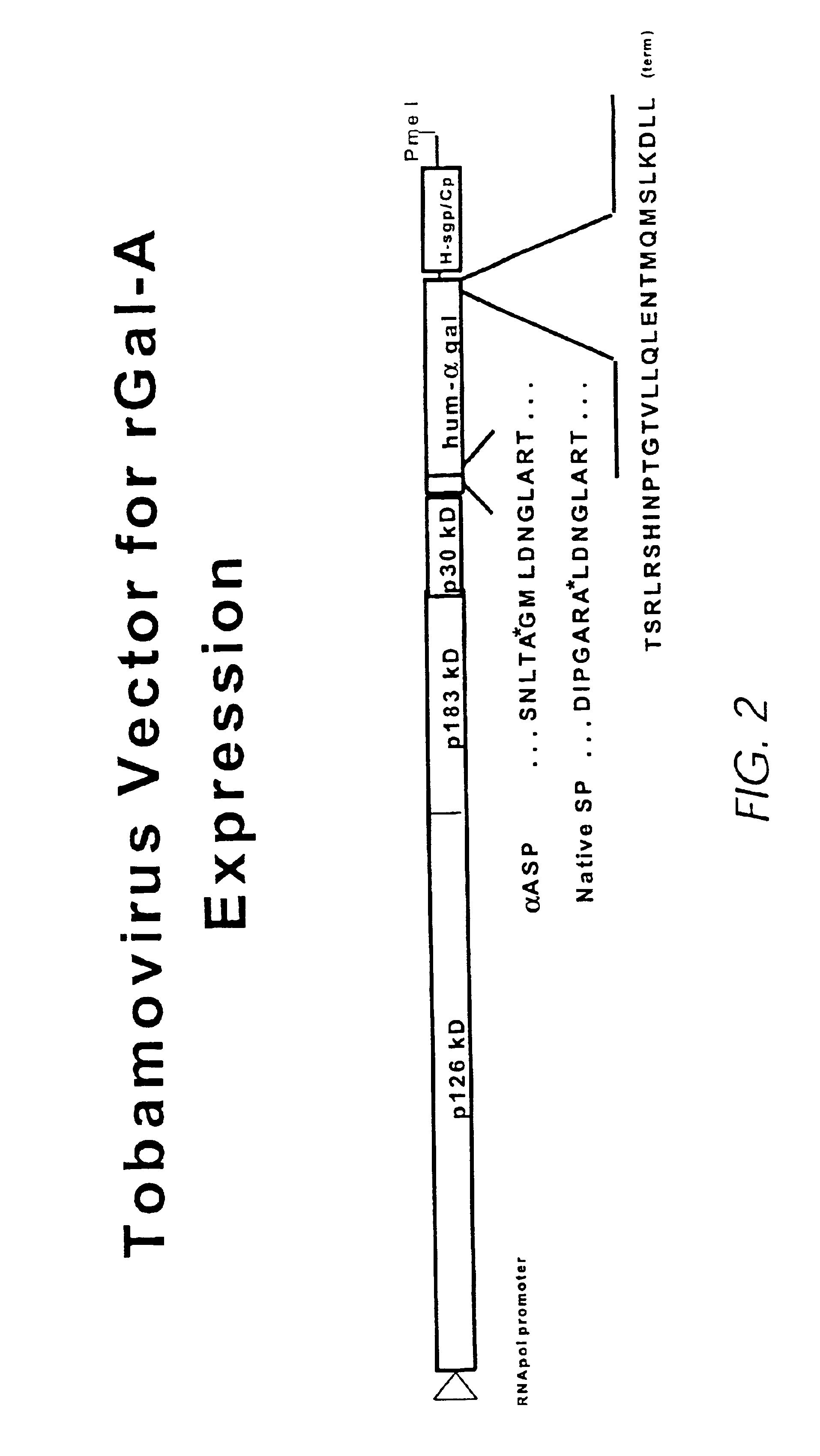 Production of lysosomal enzymes in plants by transient expression