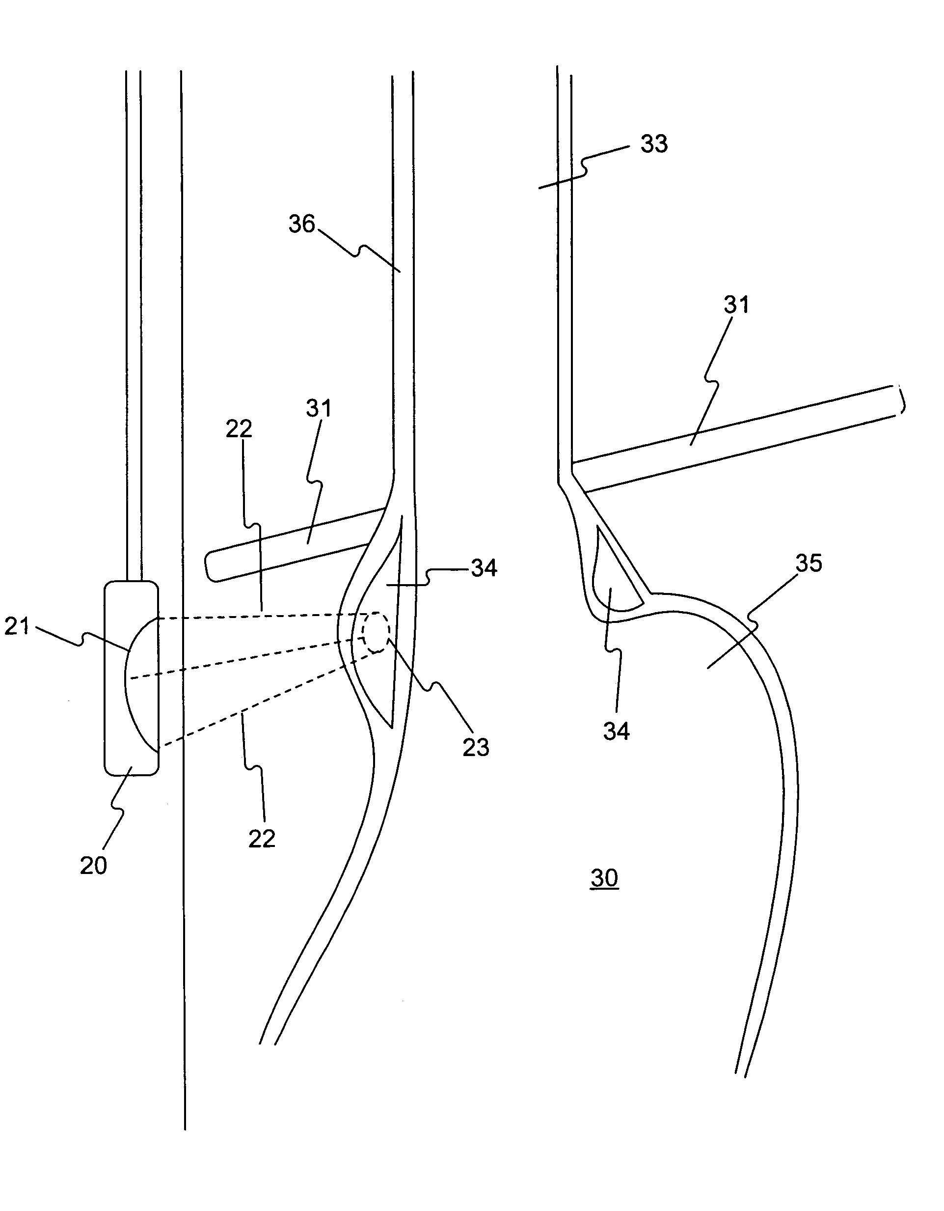 Methods of delivering energy to body portions to produce a therapeutic response