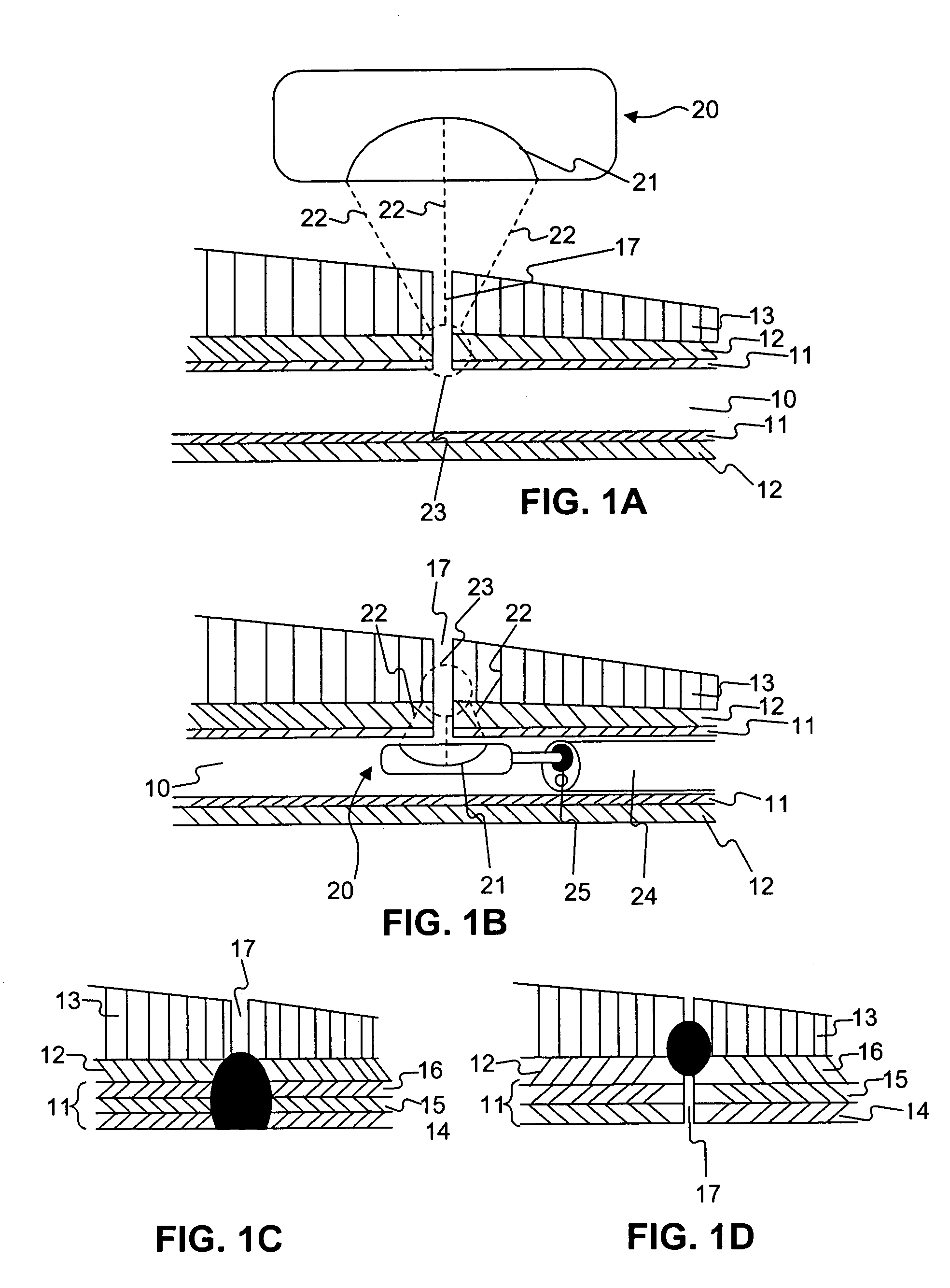 Methods of delivering energy to body portions to produce a therapeutic response