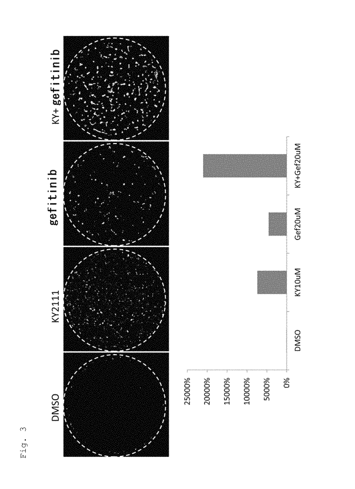 Composition for promoting cardiac differentiation of pluripotent stem cell comprising EGFR inhibitor