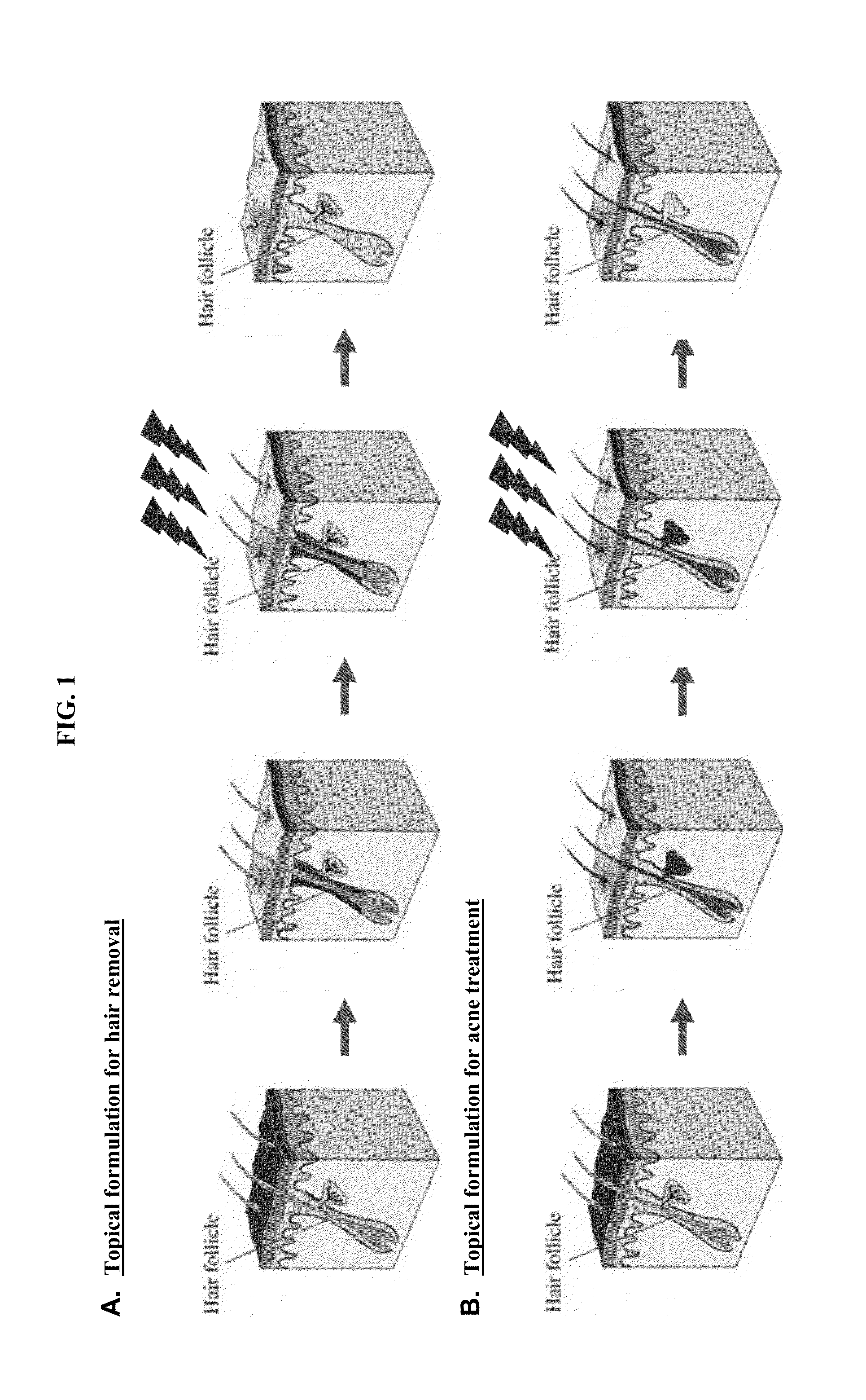 Hair Removal with Nanoparticles