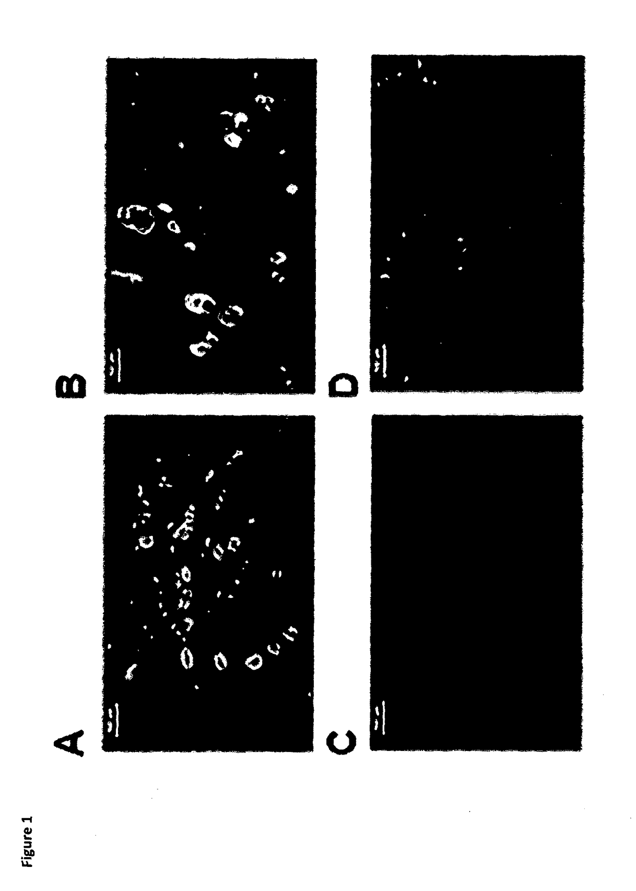 Methods of treating pain by inhibition of VGF activity