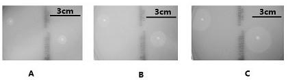 Phage and application thereof