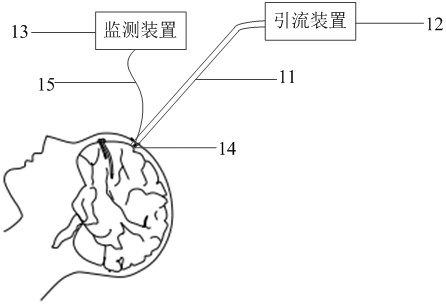 Intracranial diversion and intracranial pressure measurement integrated system