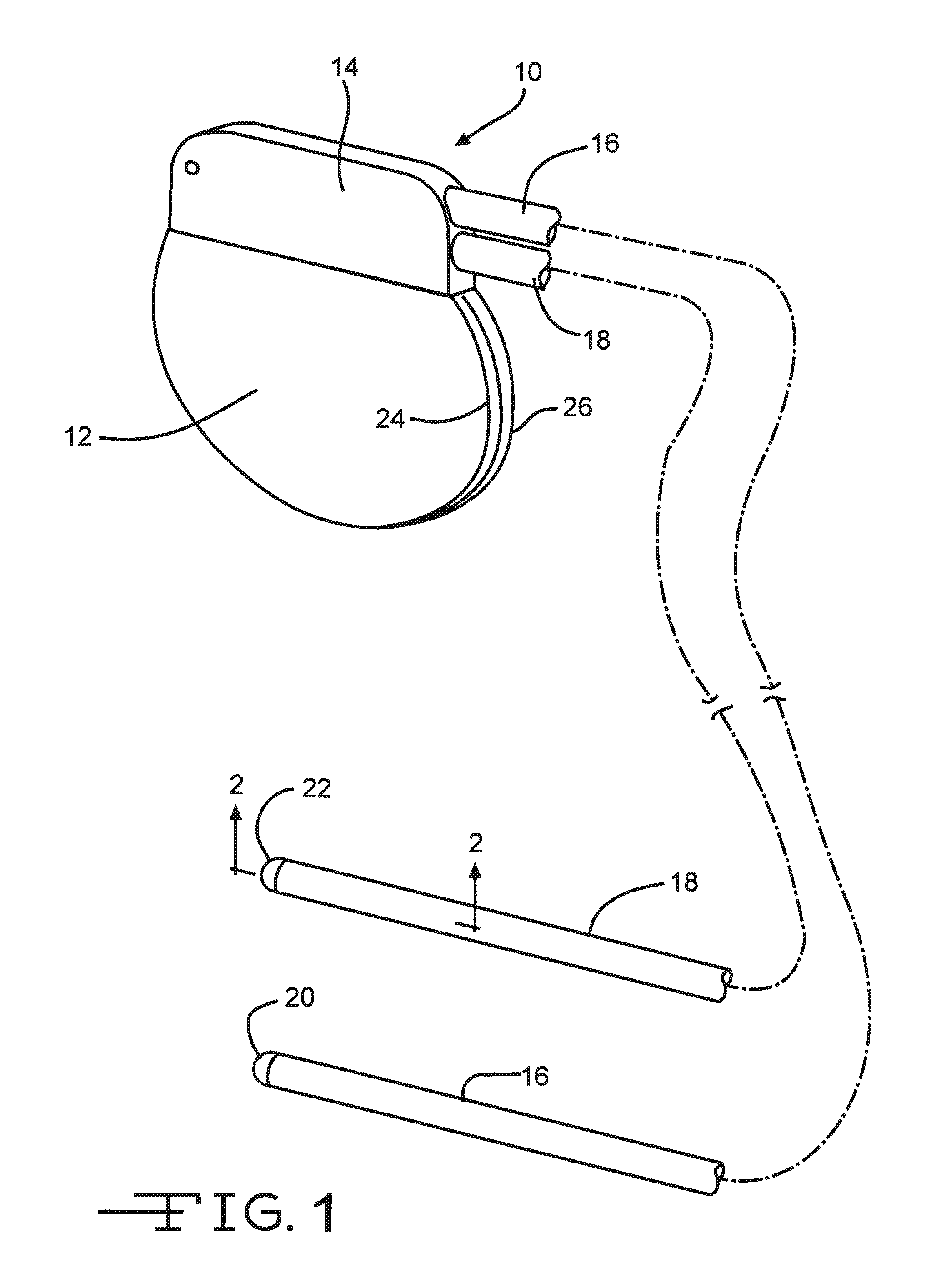 Method For Providing An Implantable Electrical Lead Wire