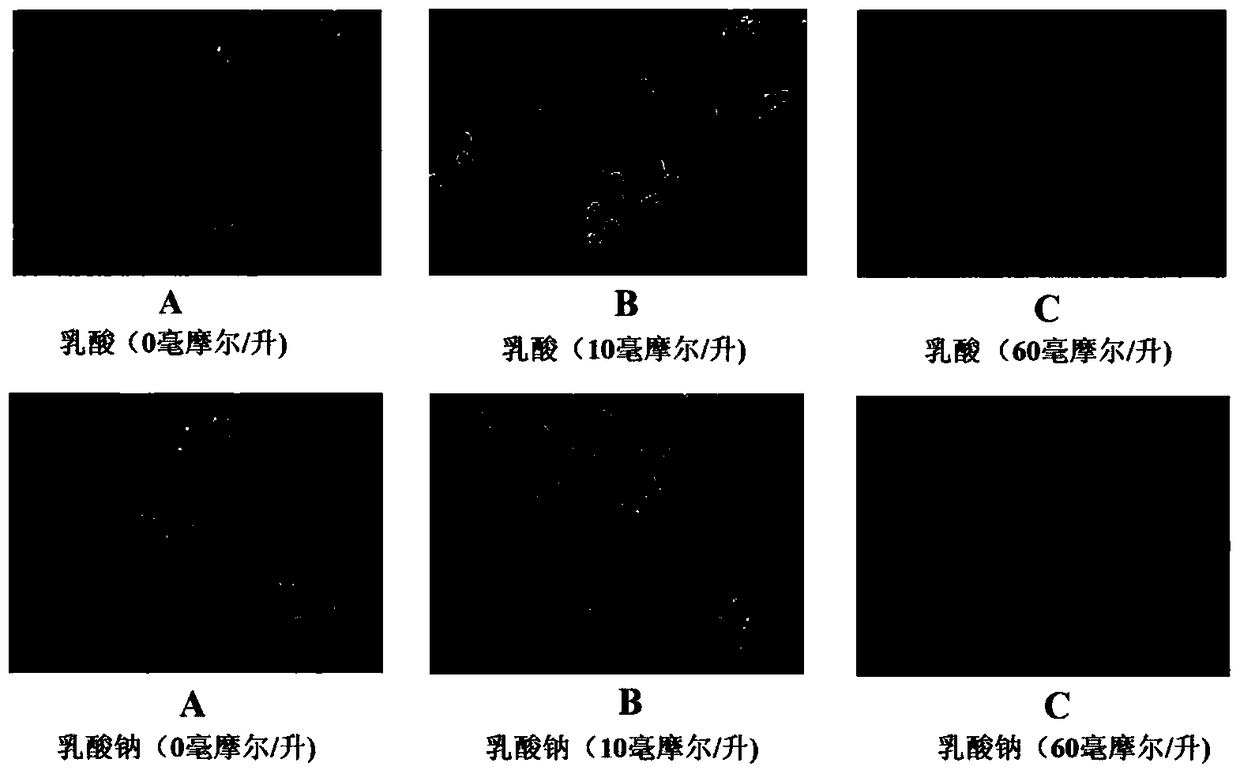 B-lymphoblastoid model induced by lactic acid to differentiate epithelioid cells and its construction and application