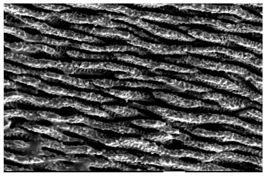 Double-sided intravascular stent with nitric oxide catalytic release function and preparation method of double-sided intravascular stent