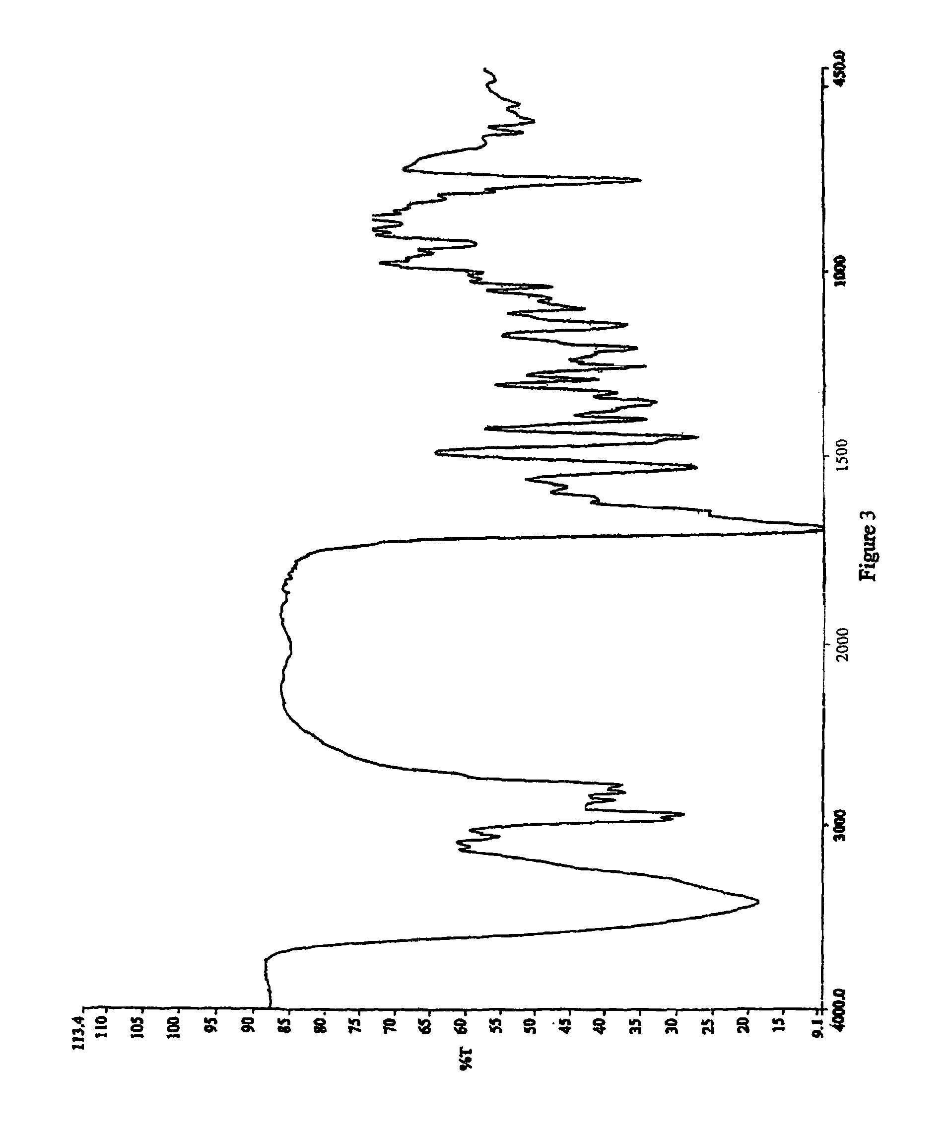 Process for the preparation of cabergoline