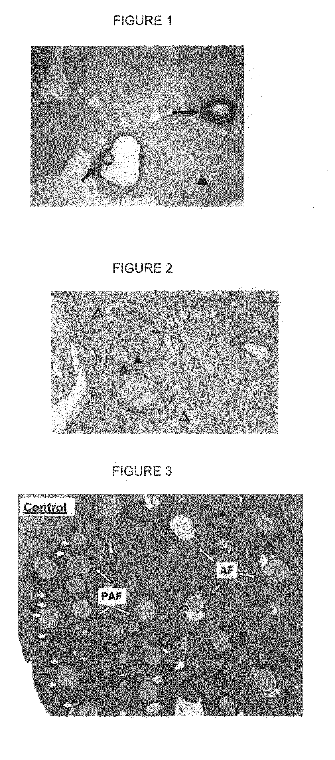 Manipulation of ovarian primordial follicles