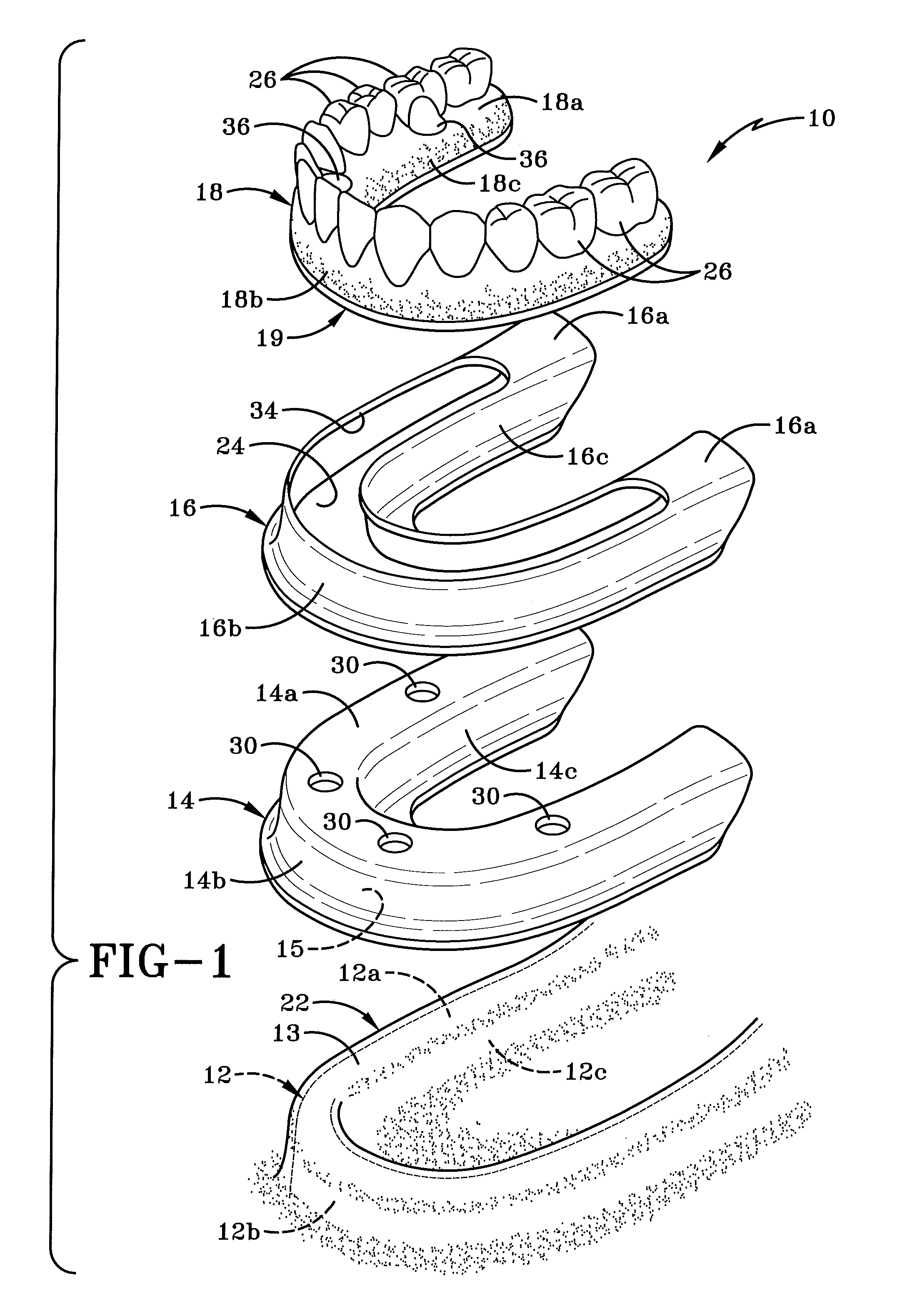 Cradle for positioning a final dental prosthesis and a system incorporating the cradle