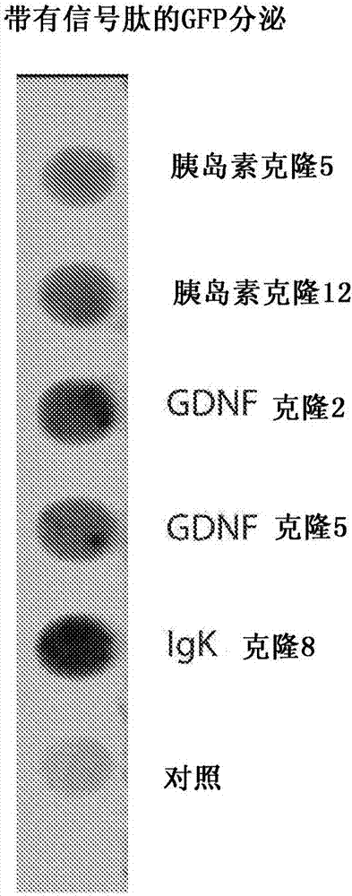 Modified UBE3A gene for a gene therapy approach for angelman syndrome